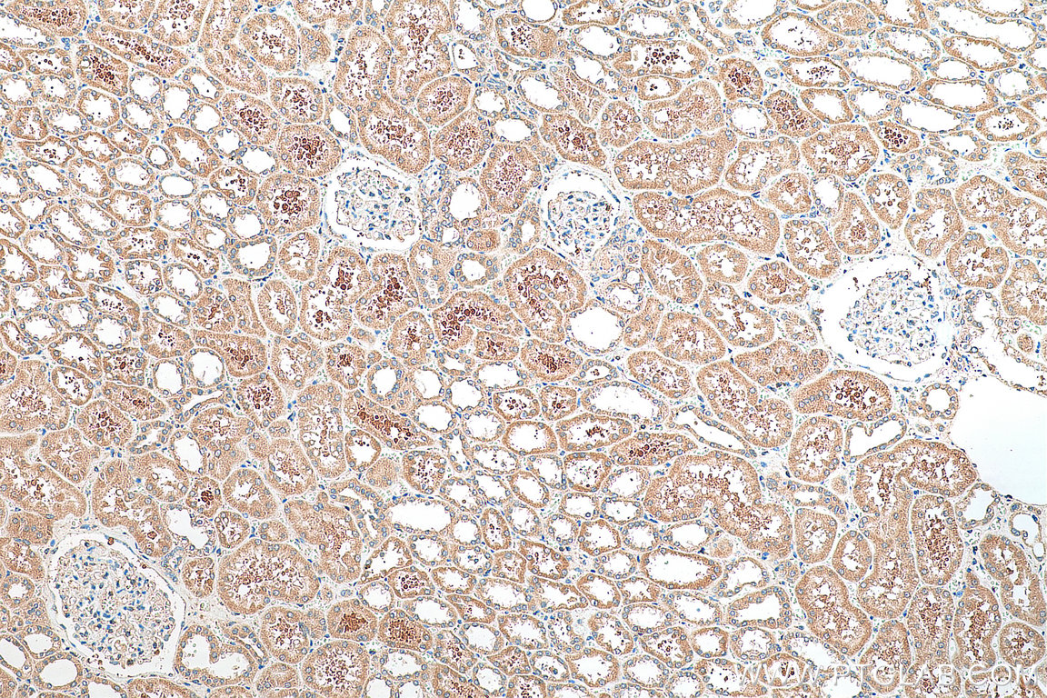 IHC staining of human kidney using 20267-1-AP