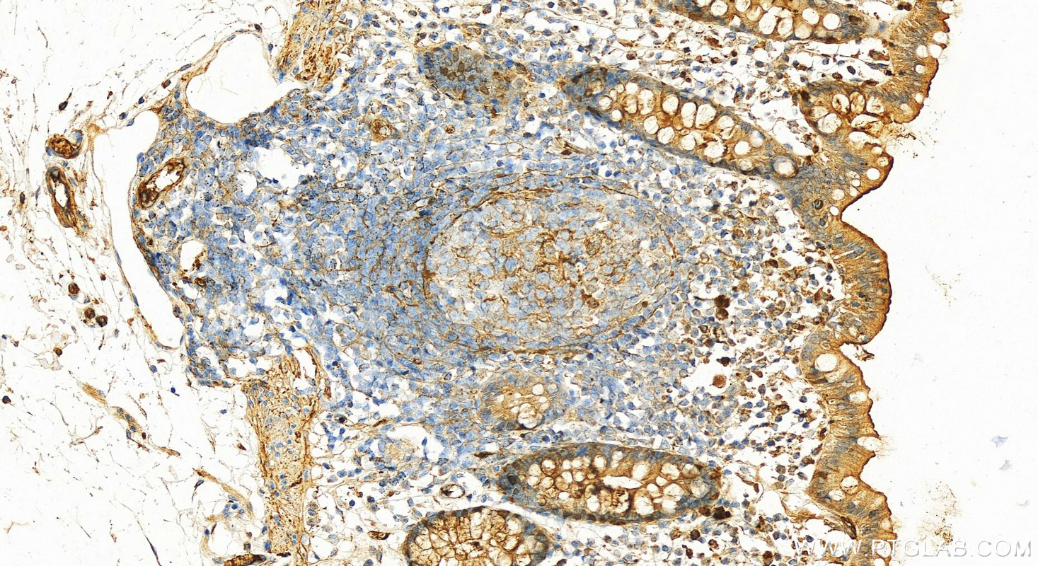 IHC staining of human colon using 16382-1-AP