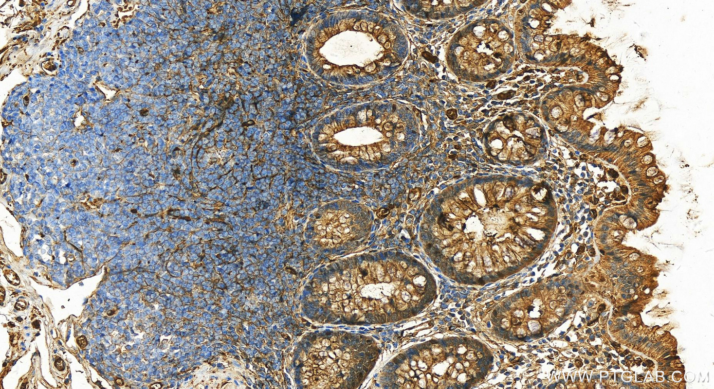 IHC staining of human colon using 16382-1-AP