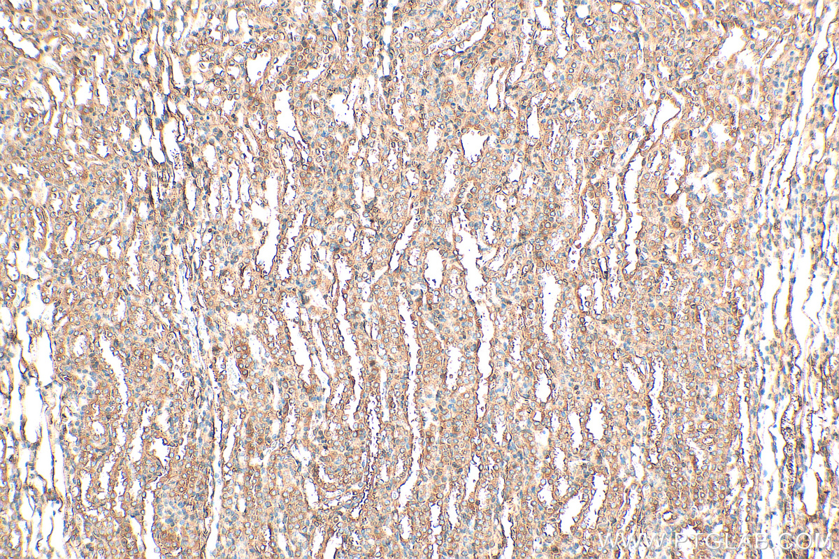 IHC staining of rat kidney using 16382-1-AP