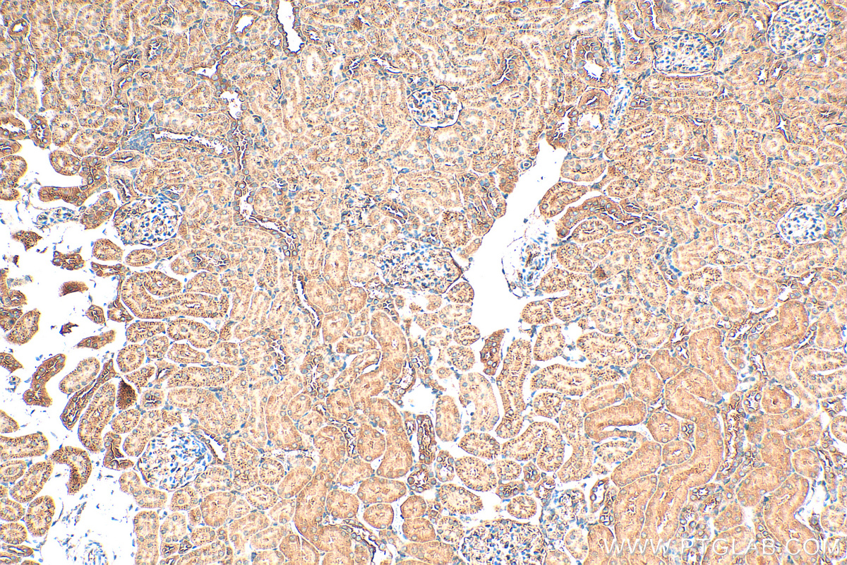 IHC staining of rat kidney using 16382-1-AP