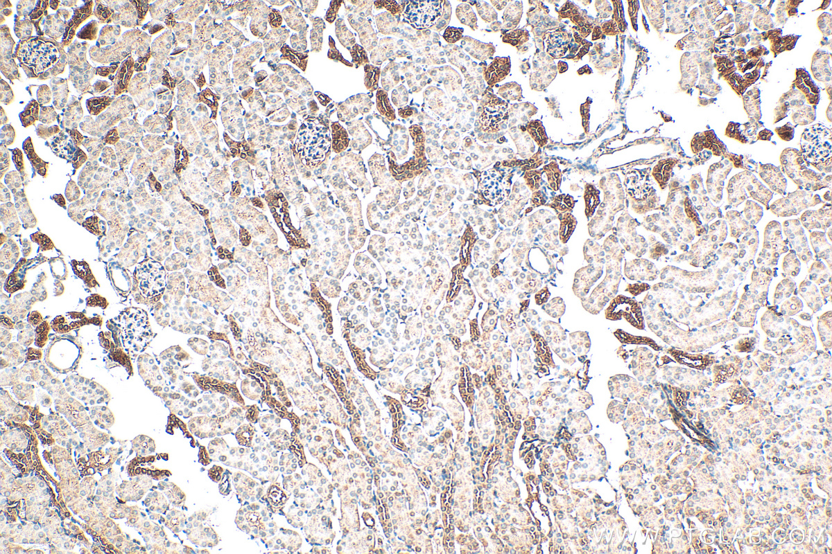 IHC staining of mouse kidney using 16382-1-AP