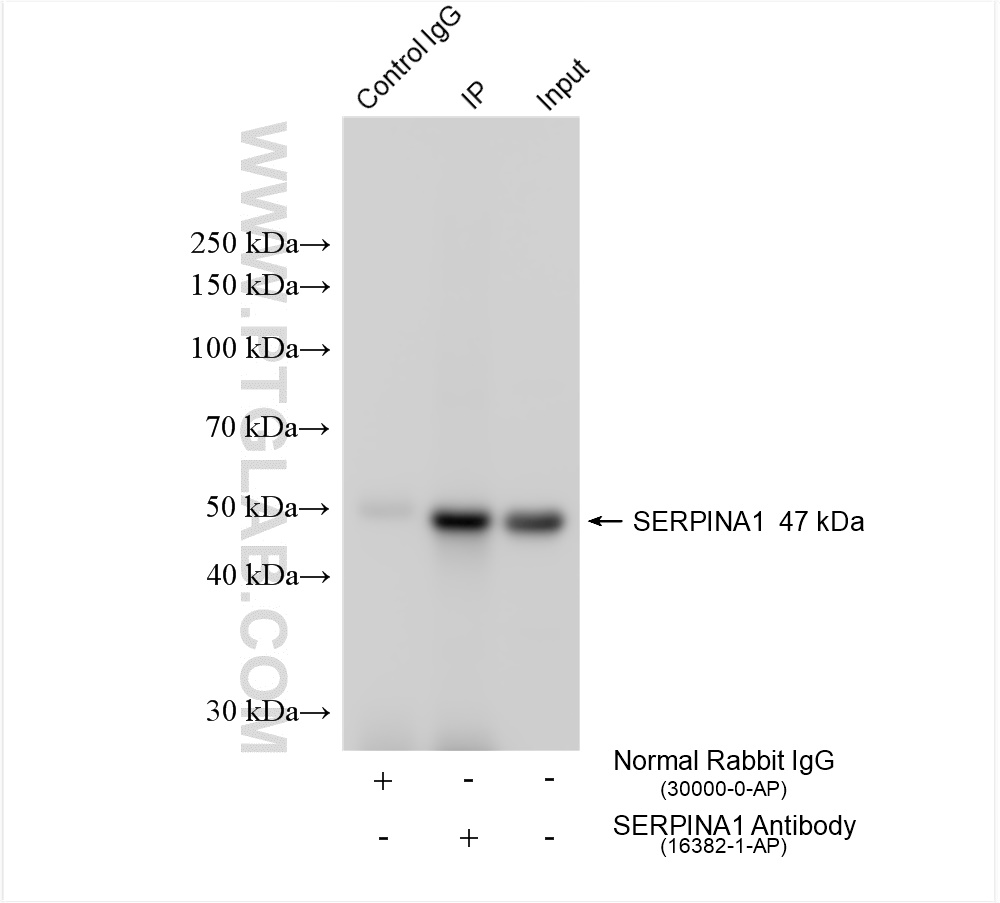 IP experiment of mouse kidney using 16382-1-AP