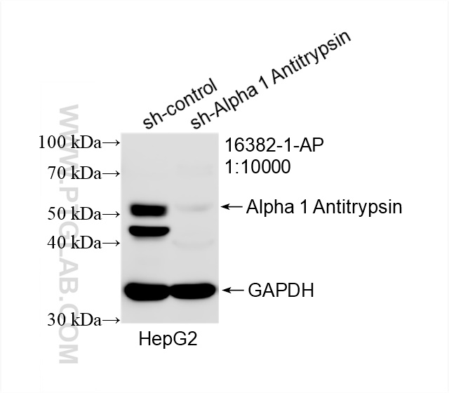 WB analysis of HepG2 using 16382-1-AP