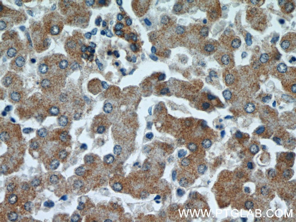 IHC staining of human liver using 11851-1-AP