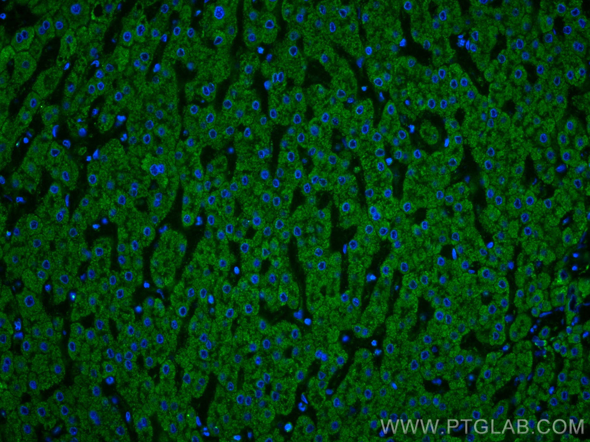 IF Staining of human liver using 60113-1-Ig (same clone as 60113-1-PBS)