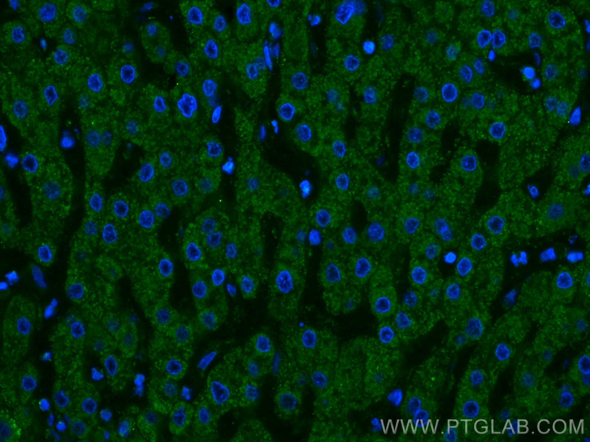 IF Staining of human liver using 60113-1-Ig (same clone as 60113-1-PBS)