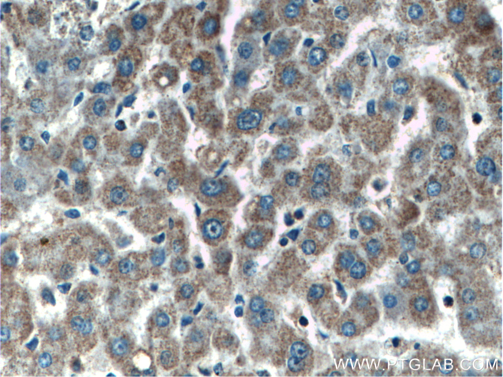 IHC staining of human liver using 60113-1-Ig (same clone as 60113-1-PBS)