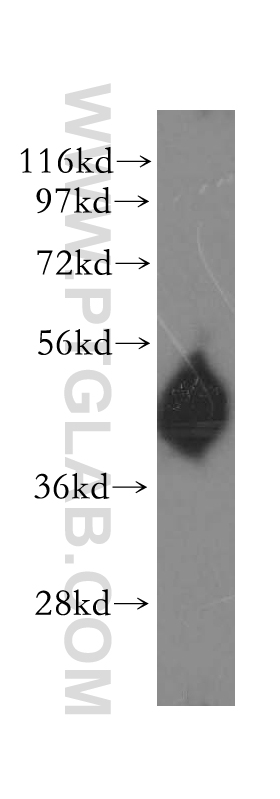 WB analysis of human spleen using 11430-2-AP