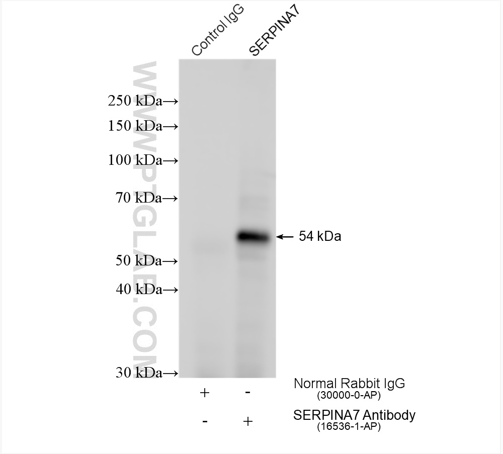 IP experiment of HepG2 using 16536-1-AP