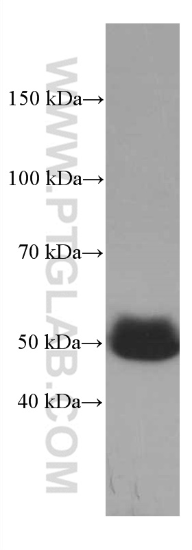 WB analysis of human plasma using 66454-1-Ig