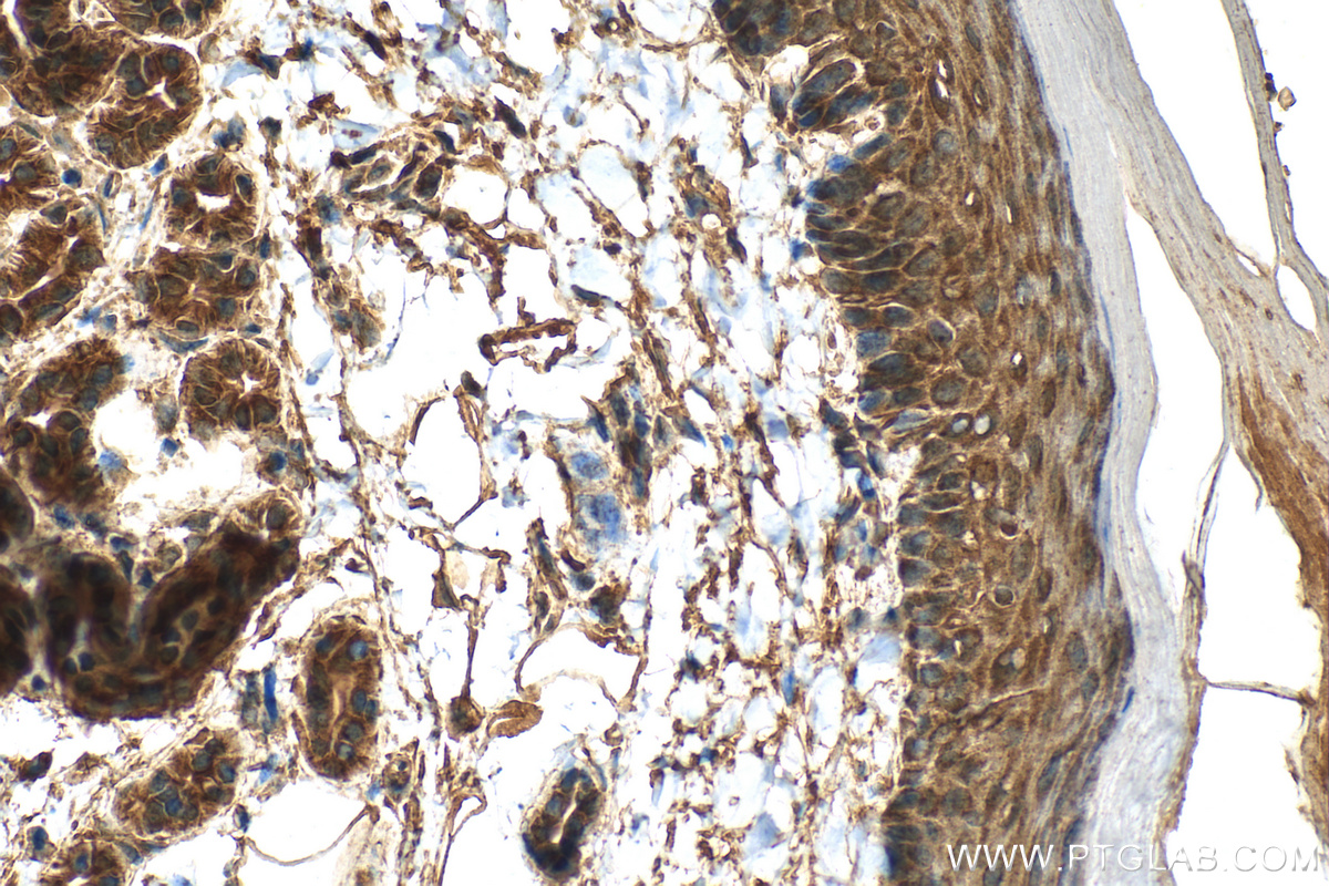 IHC staining of mouse skin using 18045-1-AP