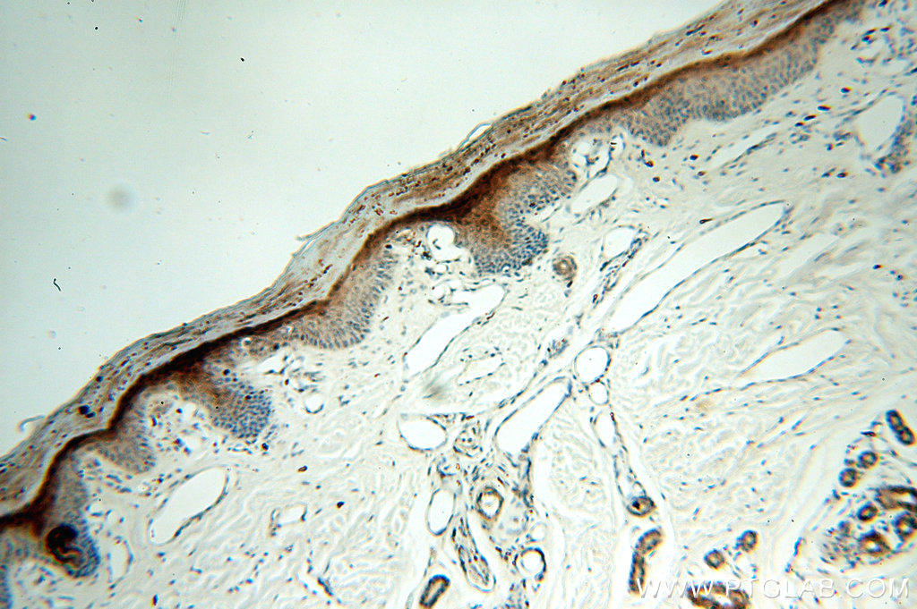 IHC staining of human skin using 18045-1-AP