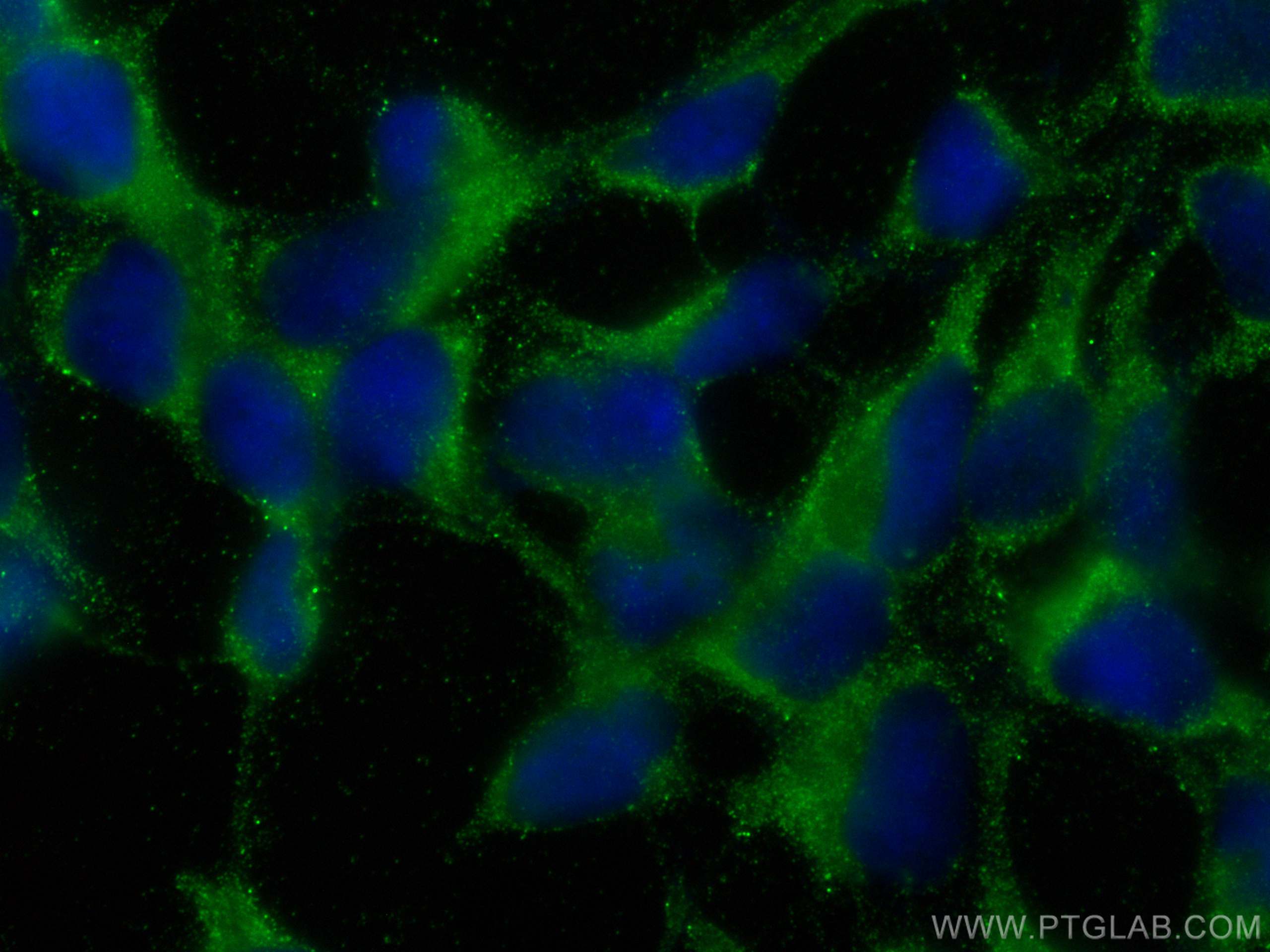 IF Staining of HEK-293 using 67633-1-Ig (same clone as 67633-1-PBS)