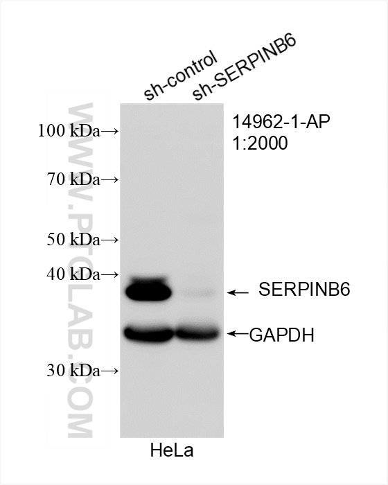 WB analysis of HeLa using 14962-1-AP