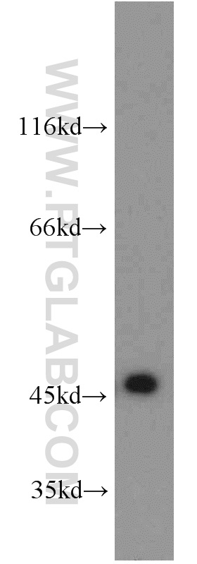 WB analysis of Jurkat using 13102-2-AP