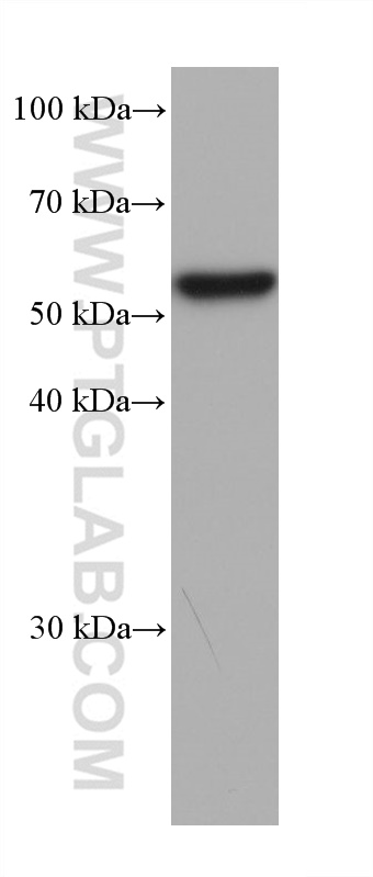 WB analysis of human plasma using 66052-1-Ig