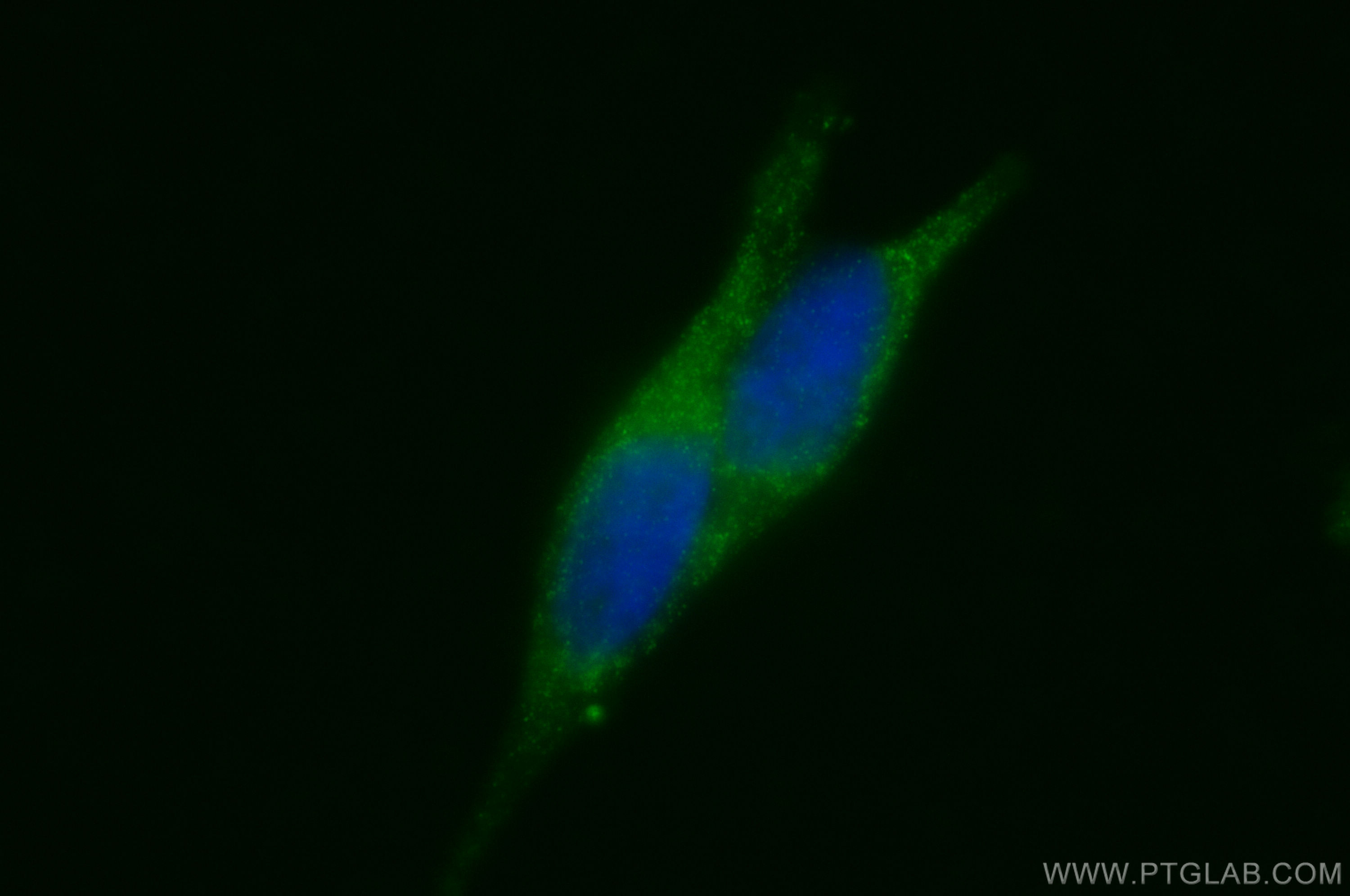 IF Staining of LNCaP using 13801-1-AP