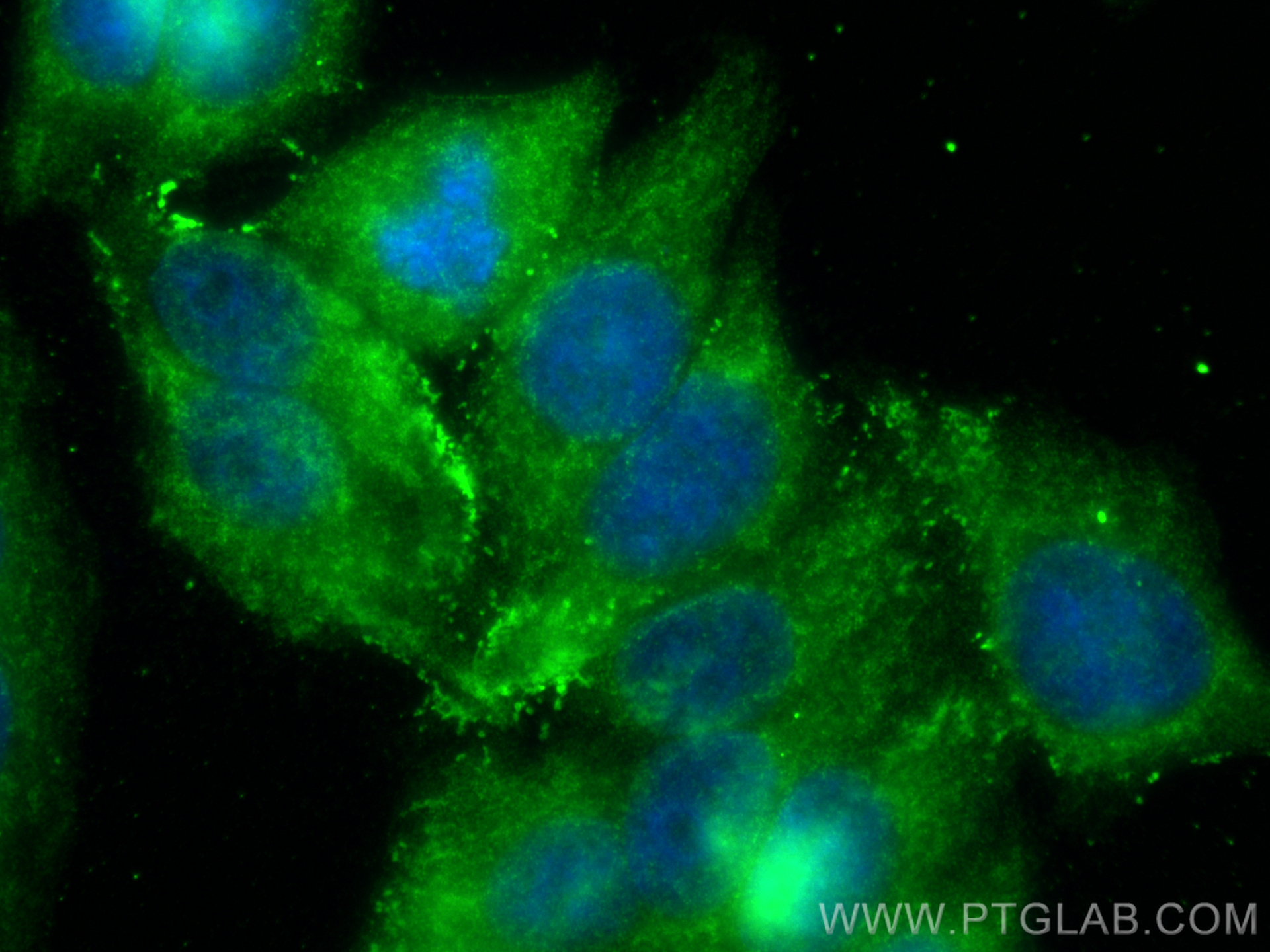 IF Staining of HepG2 using 13801-1-AP