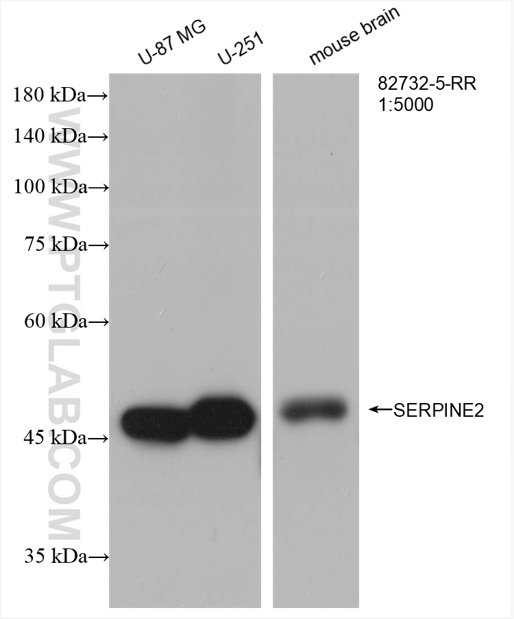 WB analysis using 82732-5-RR