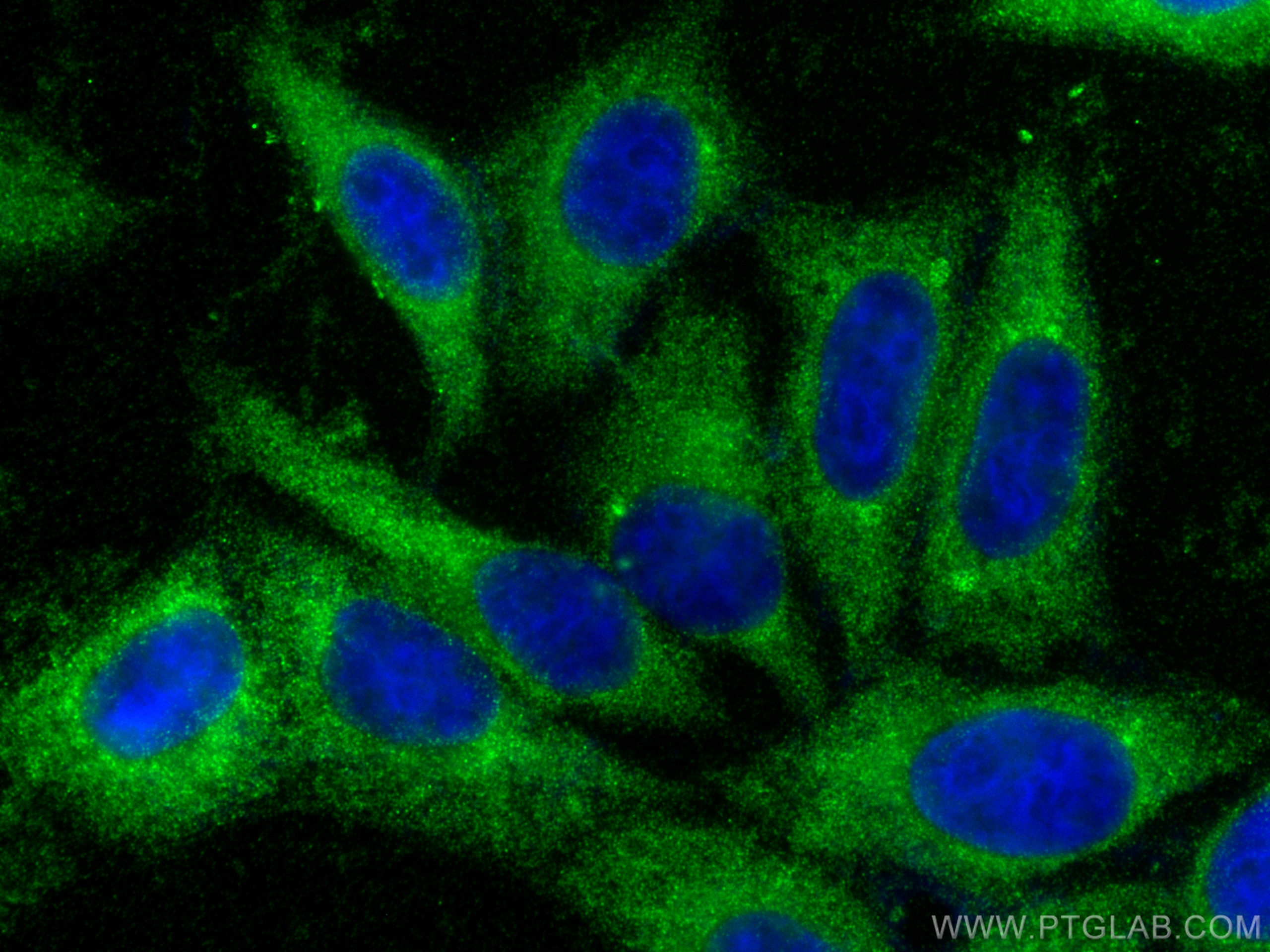 IF Staining of HepG2 using 13228-1-AP