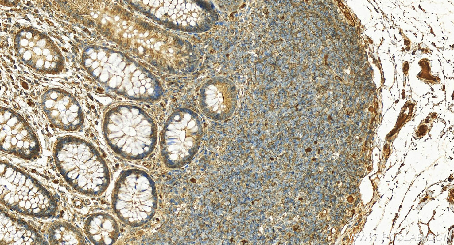 IHC staining of human normal colon using 12259-1-AP