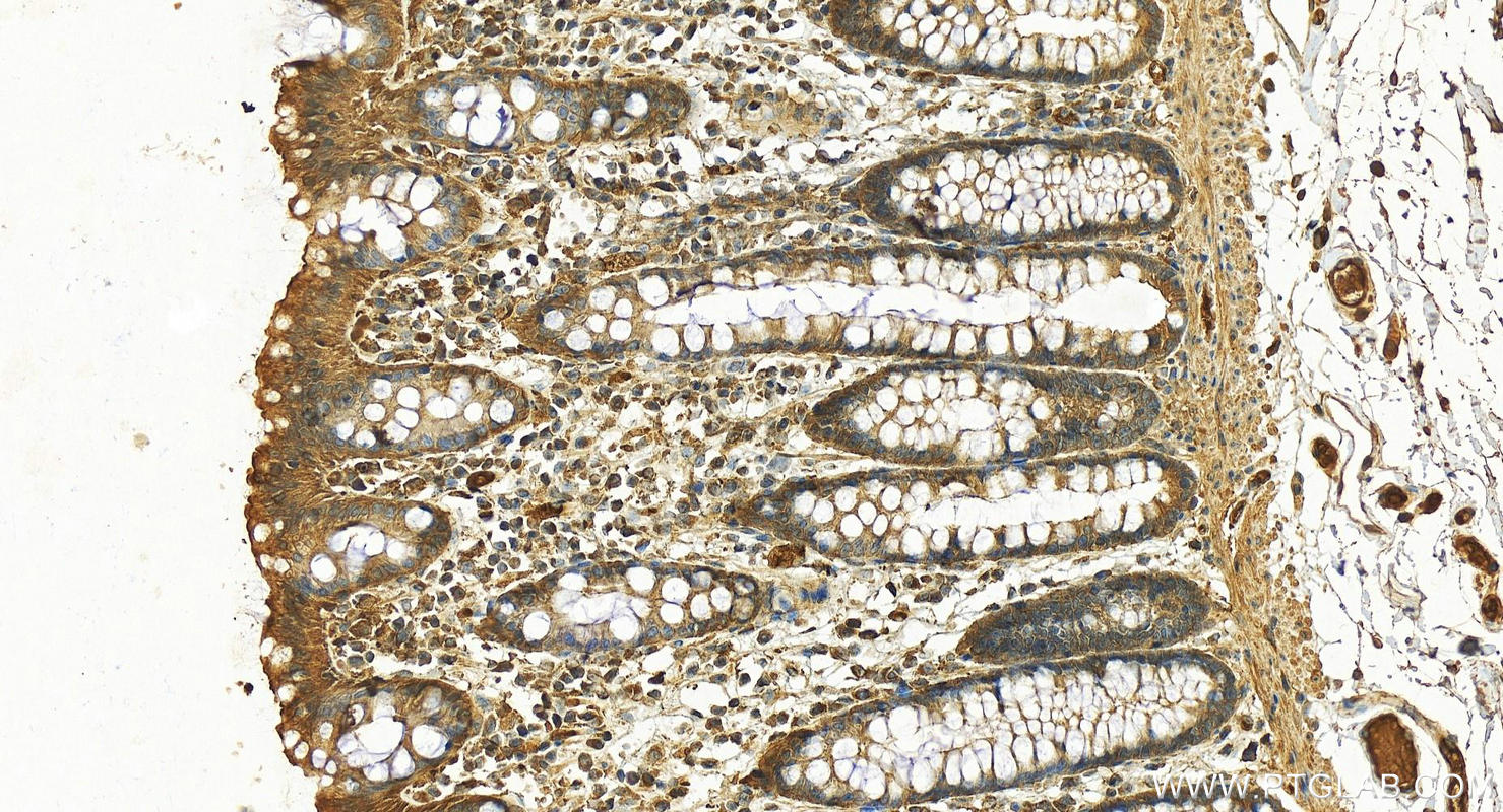 IHC staining of human normal colon using 12259-1-AP