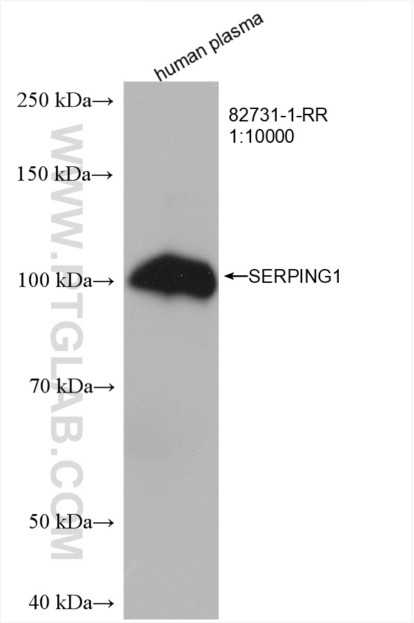 SERPING1/C1 Inactivator