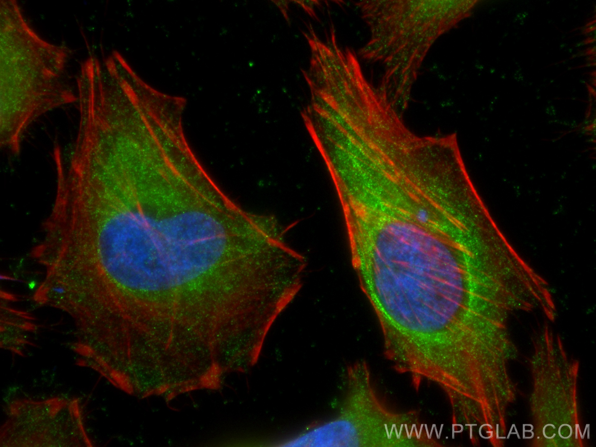 IF Staining of HeLa using 66882-1-Ig (same clone as 66882-1-PBS)