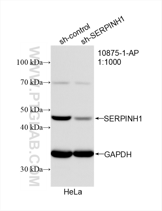 WB analysis of HeLa using 10875-1-AP