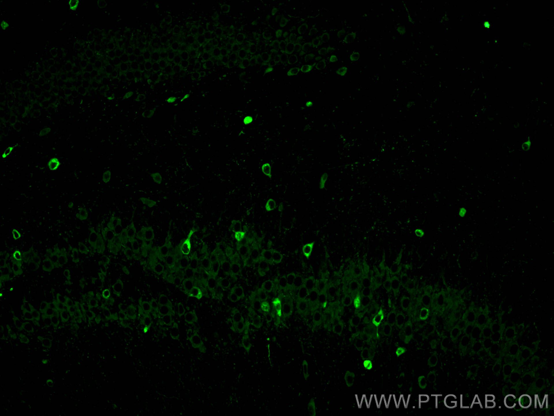 IF Staining of mouse brain using 12558-1-AP