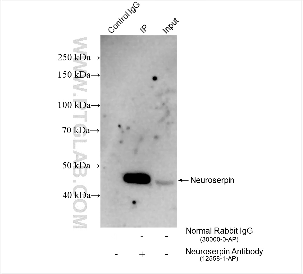 IP experiment of rat brain using 12558-1-AP