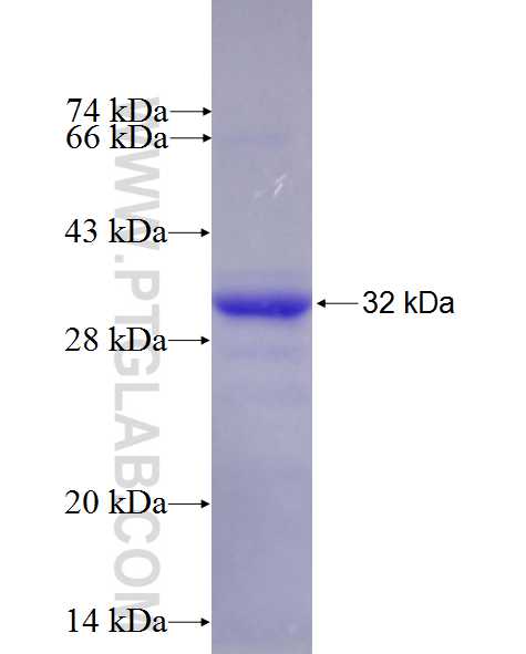 SERTAD1 fusion protein Ag25568 SDS-PAGE