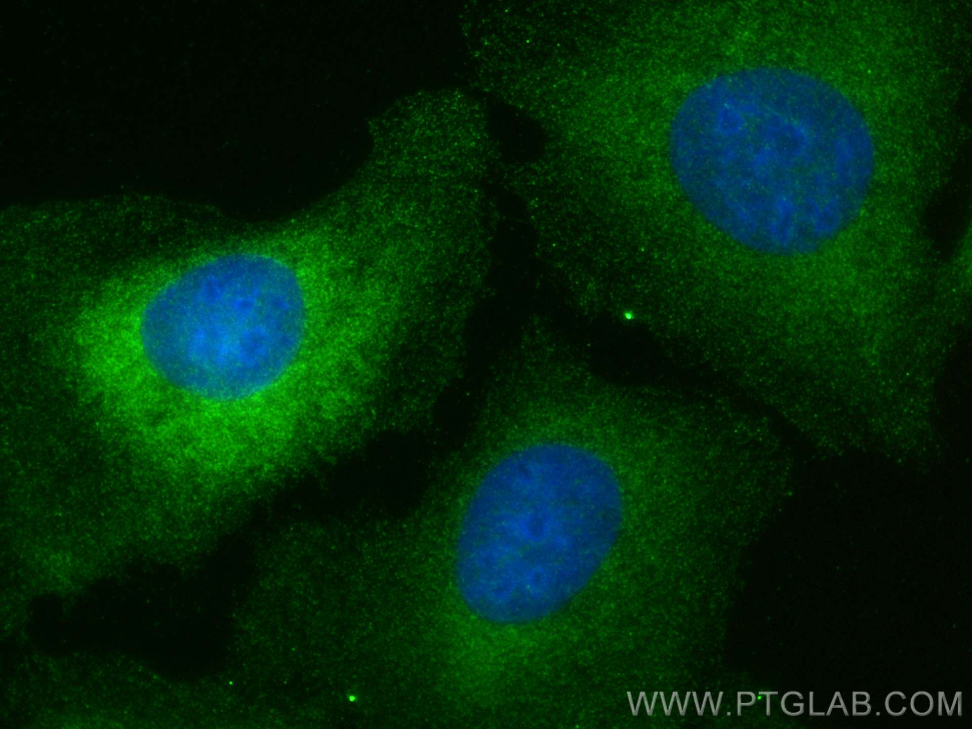 IF Staining of U2OS using 21346-1-AP