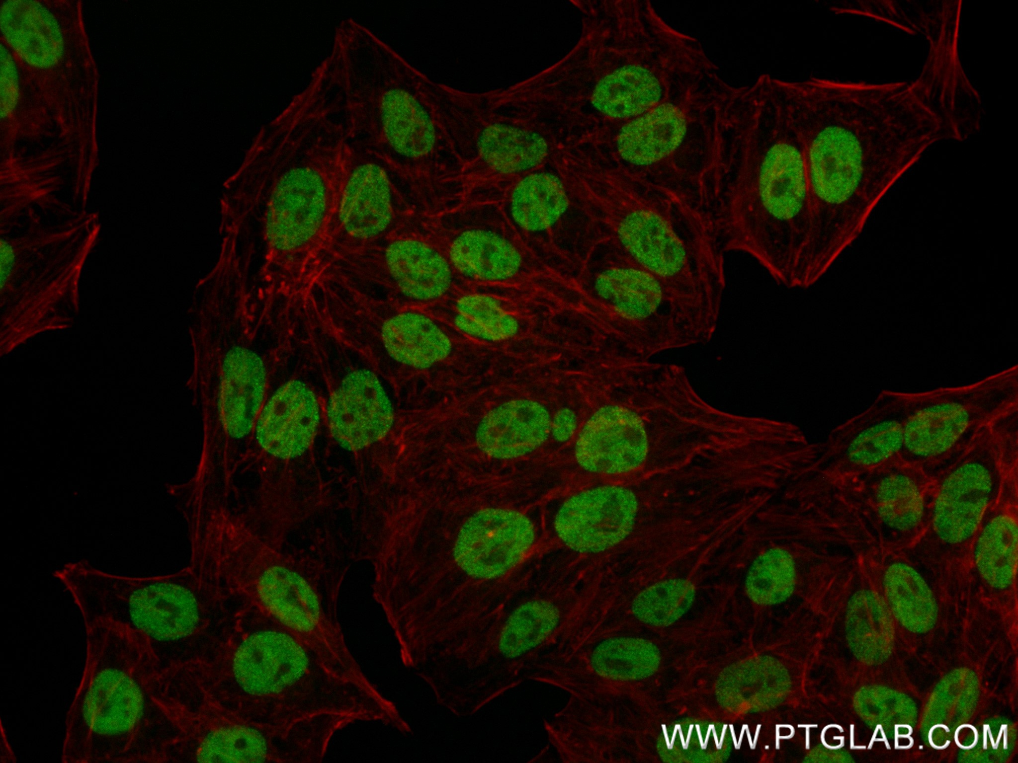 IF Staining of HepG2 using 84823-3-RR