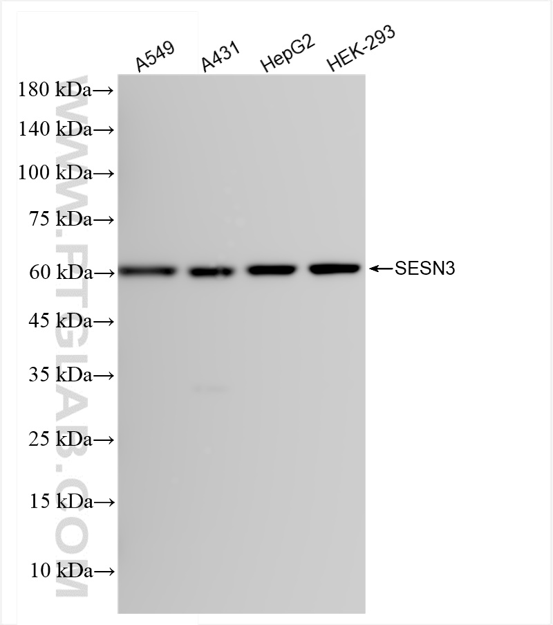 WB analysis using 84823-3-RR