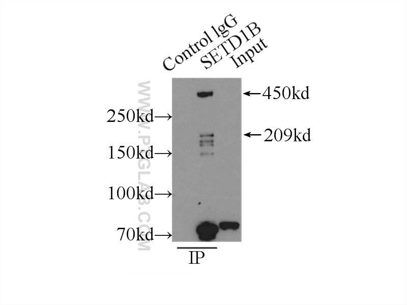 IP experiment of MCF-7 using 55005-1-AP