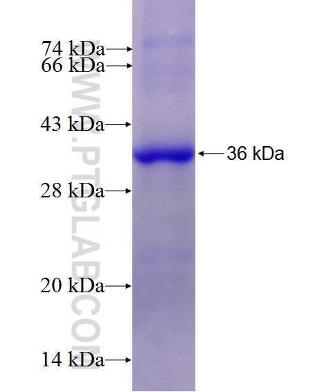 SETD4 fusion protein Ag27451 SDS-PAGE