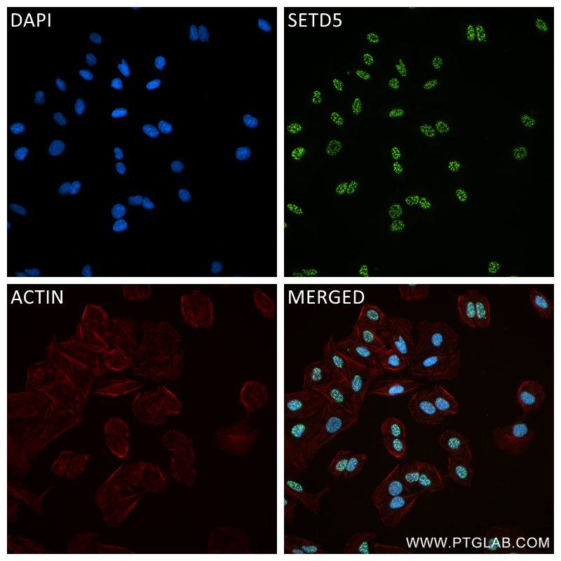 IF Staining of U2OS using 84622-1-RR (same clone as 84622-1-PBS)