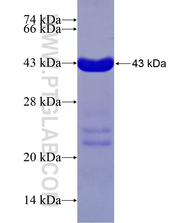 SETD5 fusion protein Ag28929 SDS-PAGE