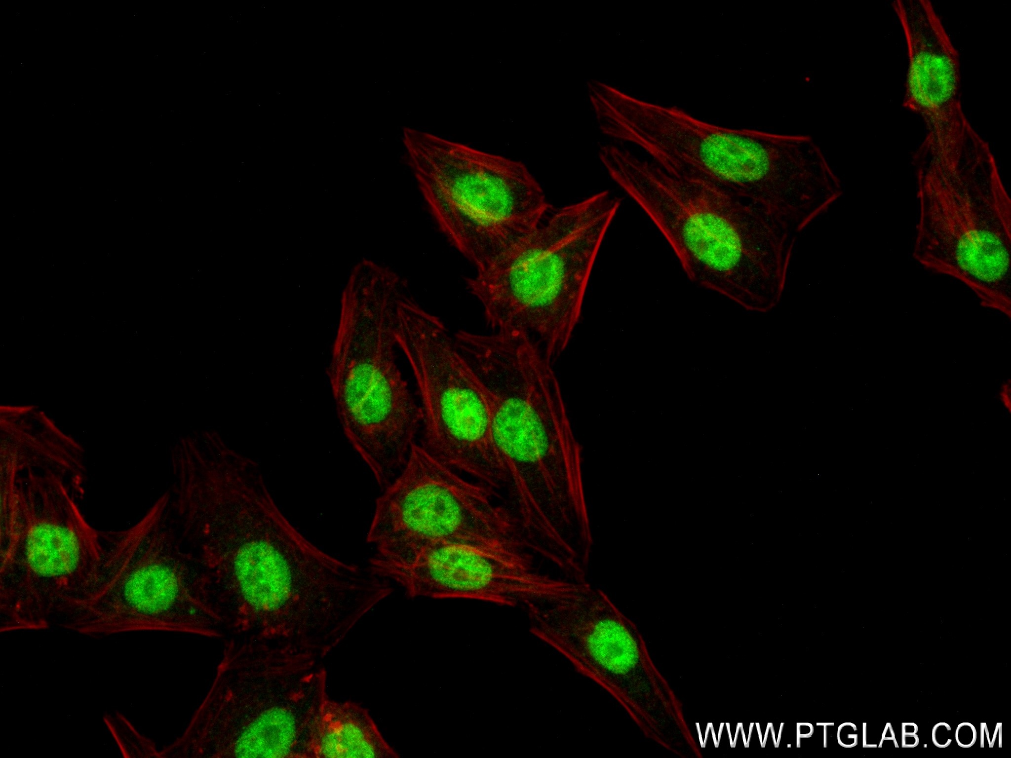 IF Staining of HepG2 using 83772-6-RR