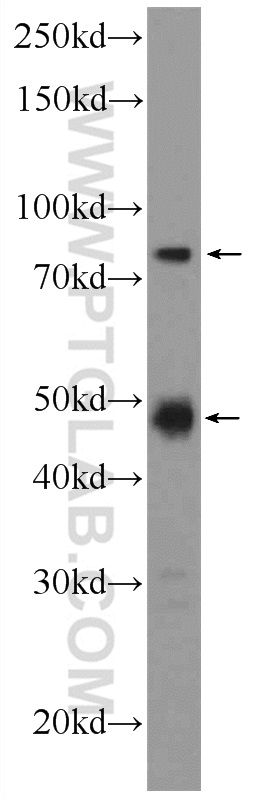 WB analysis of HL-60 using 25814-1-AP