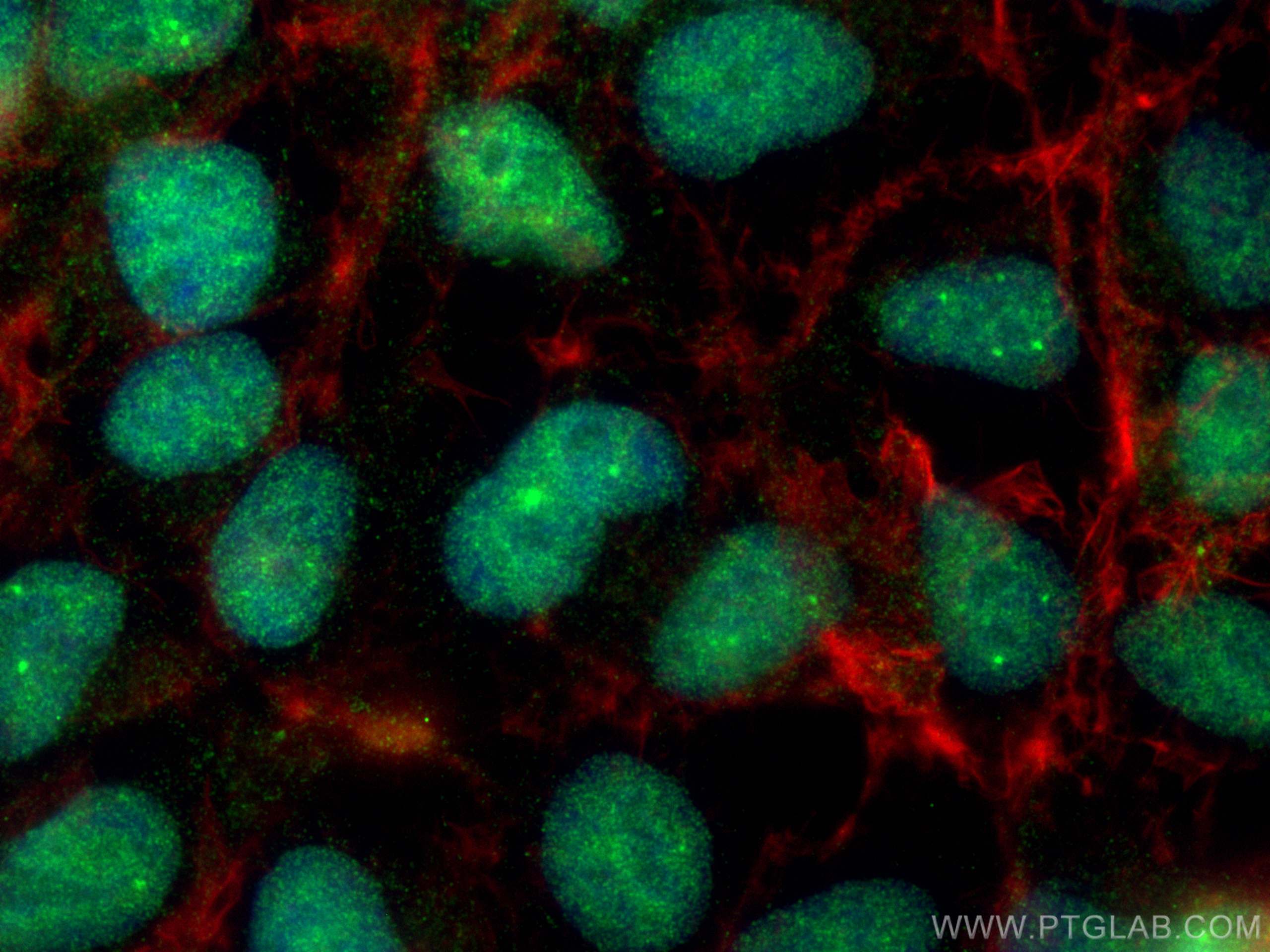 IF Staining of HEK-293 using 10919-1-AP