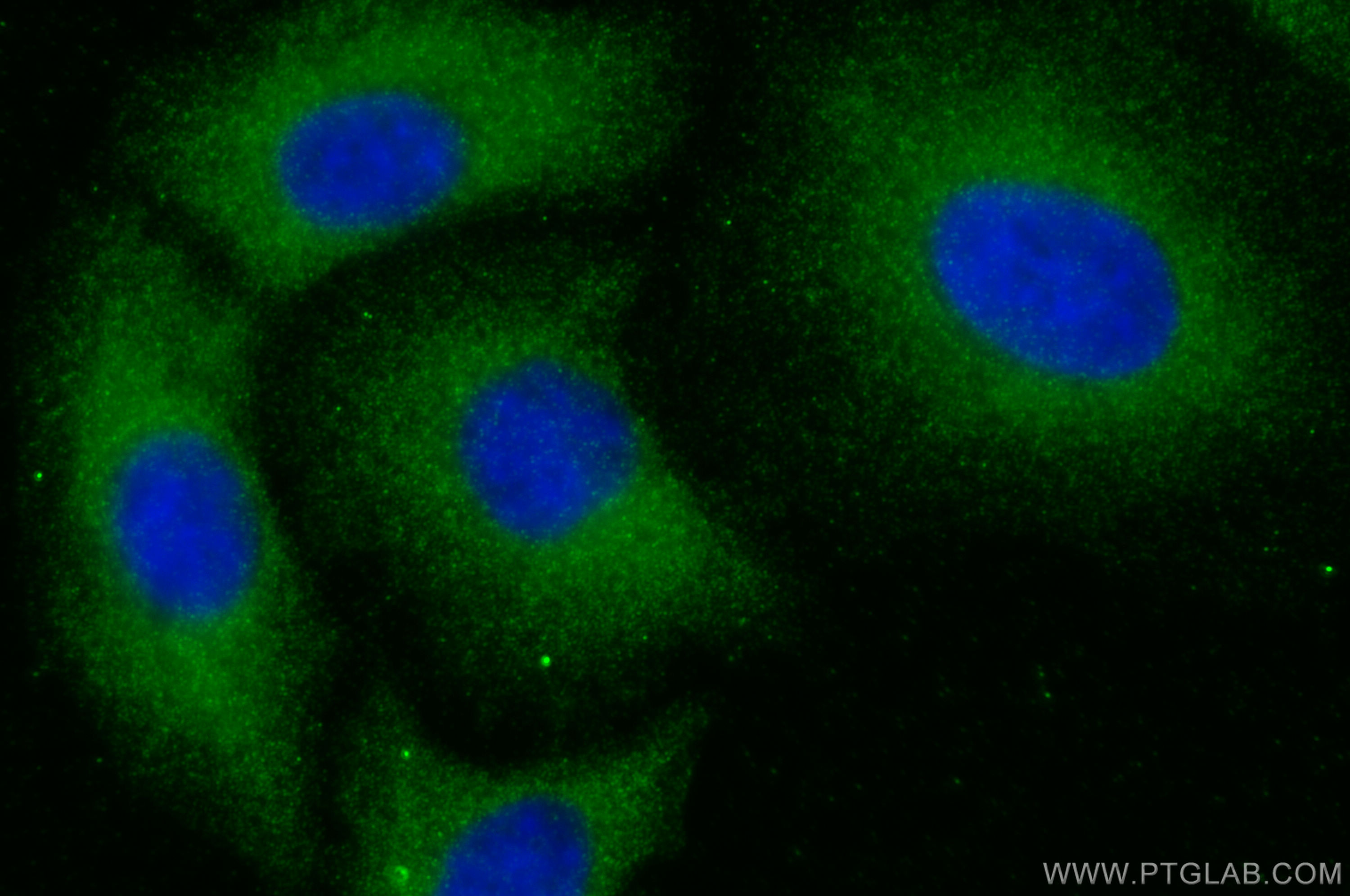 IF Staining of A549 using 14283-1-AP