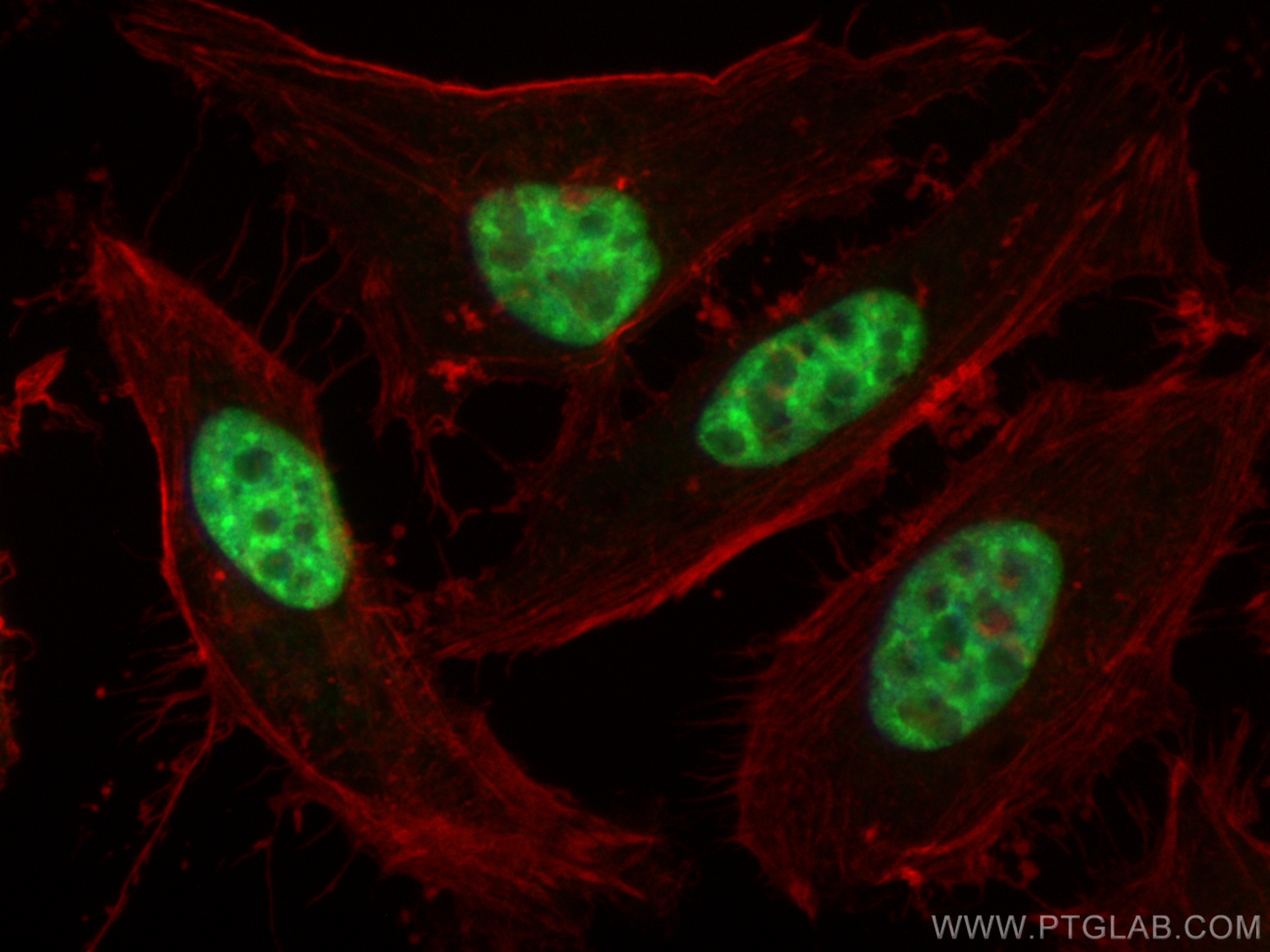 IF Staining of HeLa using 12929-2-AP