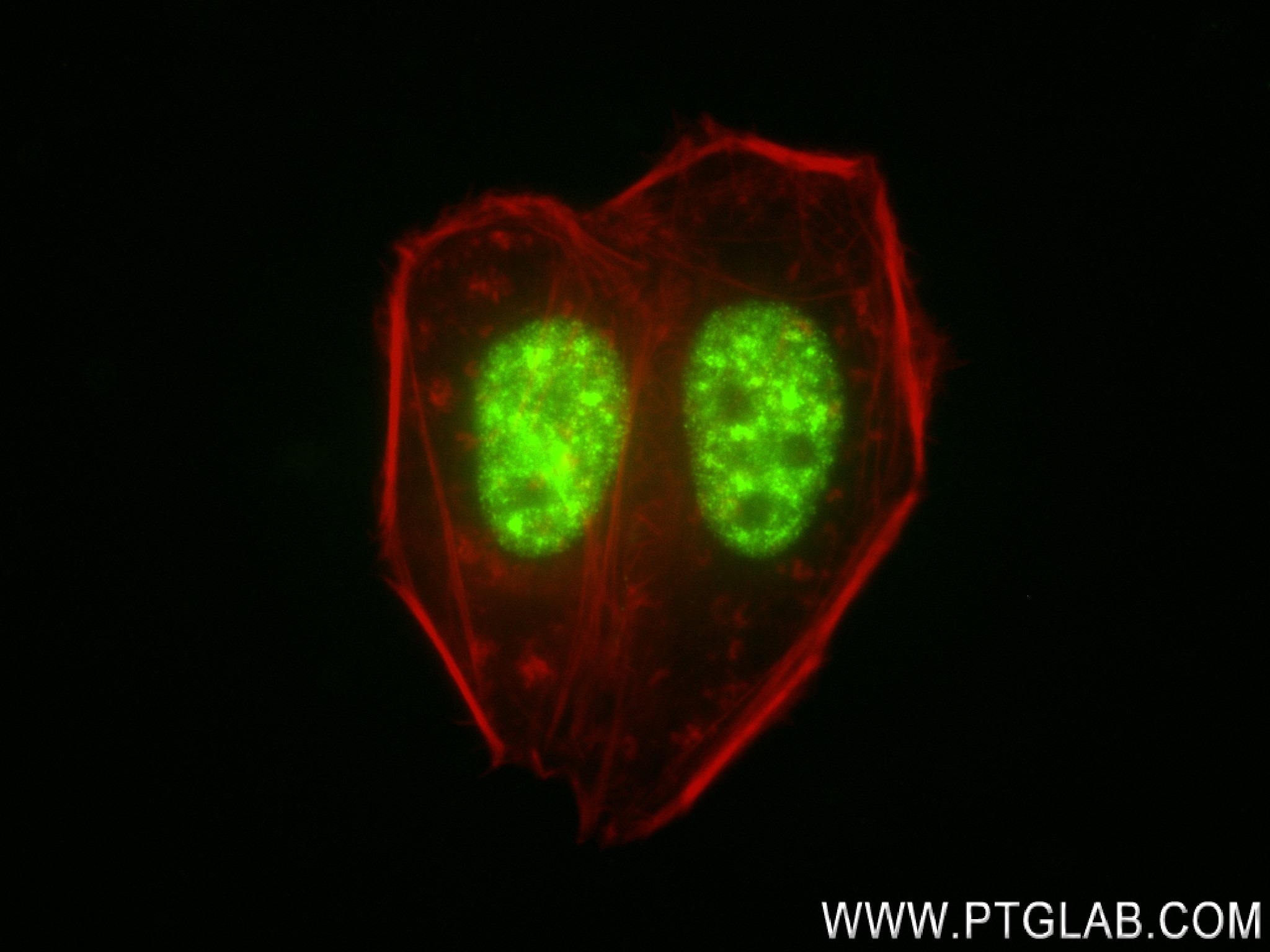 IF Staining of HepG2 using 83605-6-RR