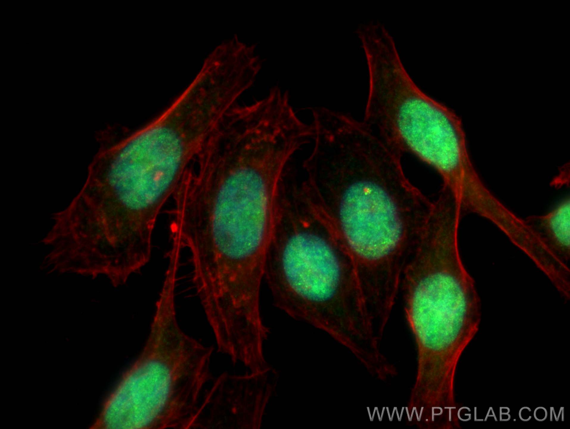 IF Staining of HepG2 using 20371-1-AP