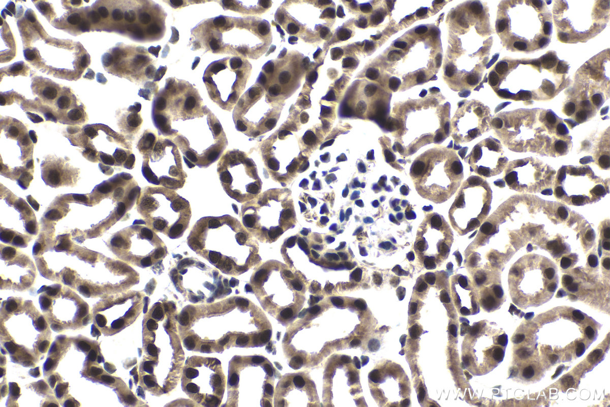 IHC staining of mouse kidney using 17926-1-AP