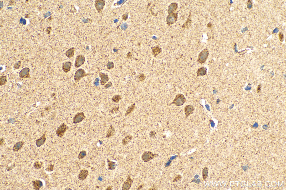 IHC staining of mouse brain using 15156-1-AP