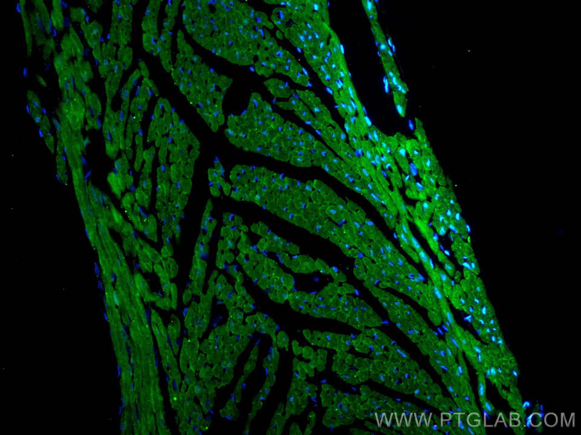 IF Staining of mouse heart using 21614-1-AP